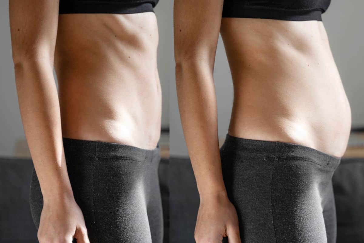 How long does diastasis recti take to improve Virginia Water?